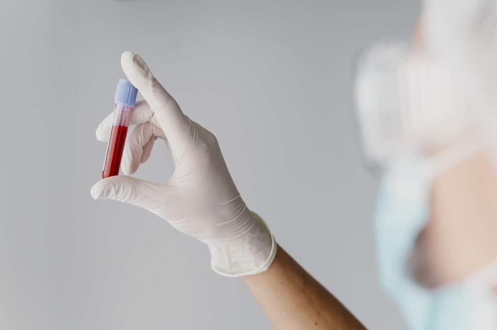 exames laboratoriais