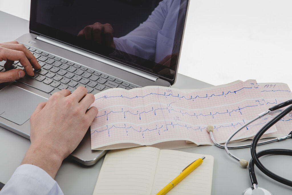 eletrocardiograma