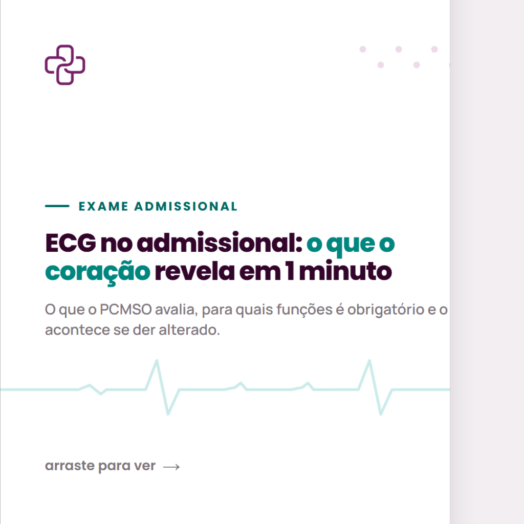 eletrocardiograma