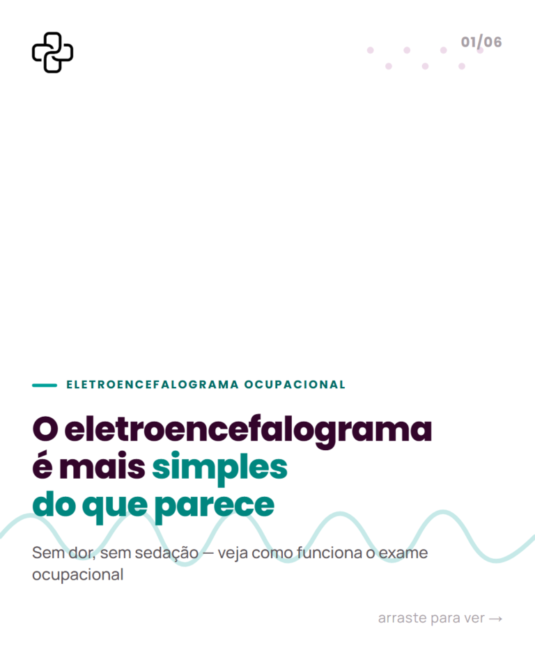 eletroencefalograma